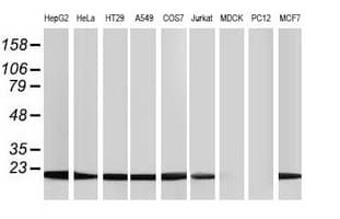 NDUFB9 Antibody (aa3-179, clone OTI8B7)