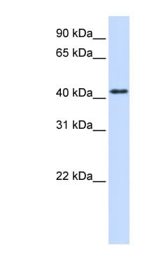 PTPRR Antibody (aa72-121)