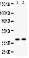 NDRG2 Antibody (aa212-230)