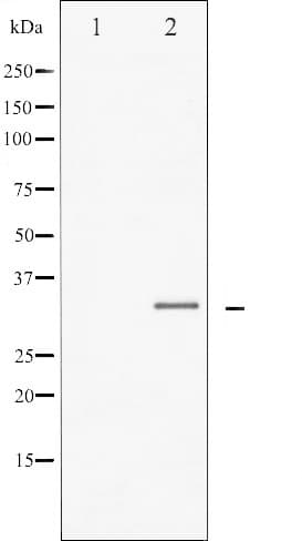 C/EBP Beta / CEBPB Antibody