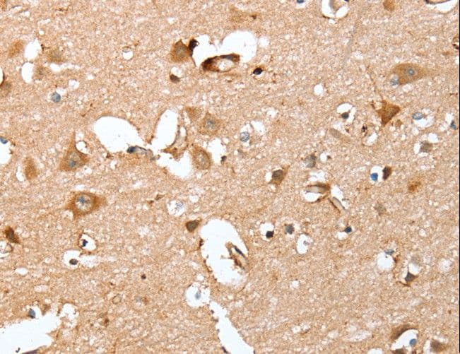 CAPG Antibody