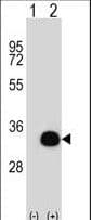 SIRT5 / Sirtuin 5 Antibody (aa99-127)