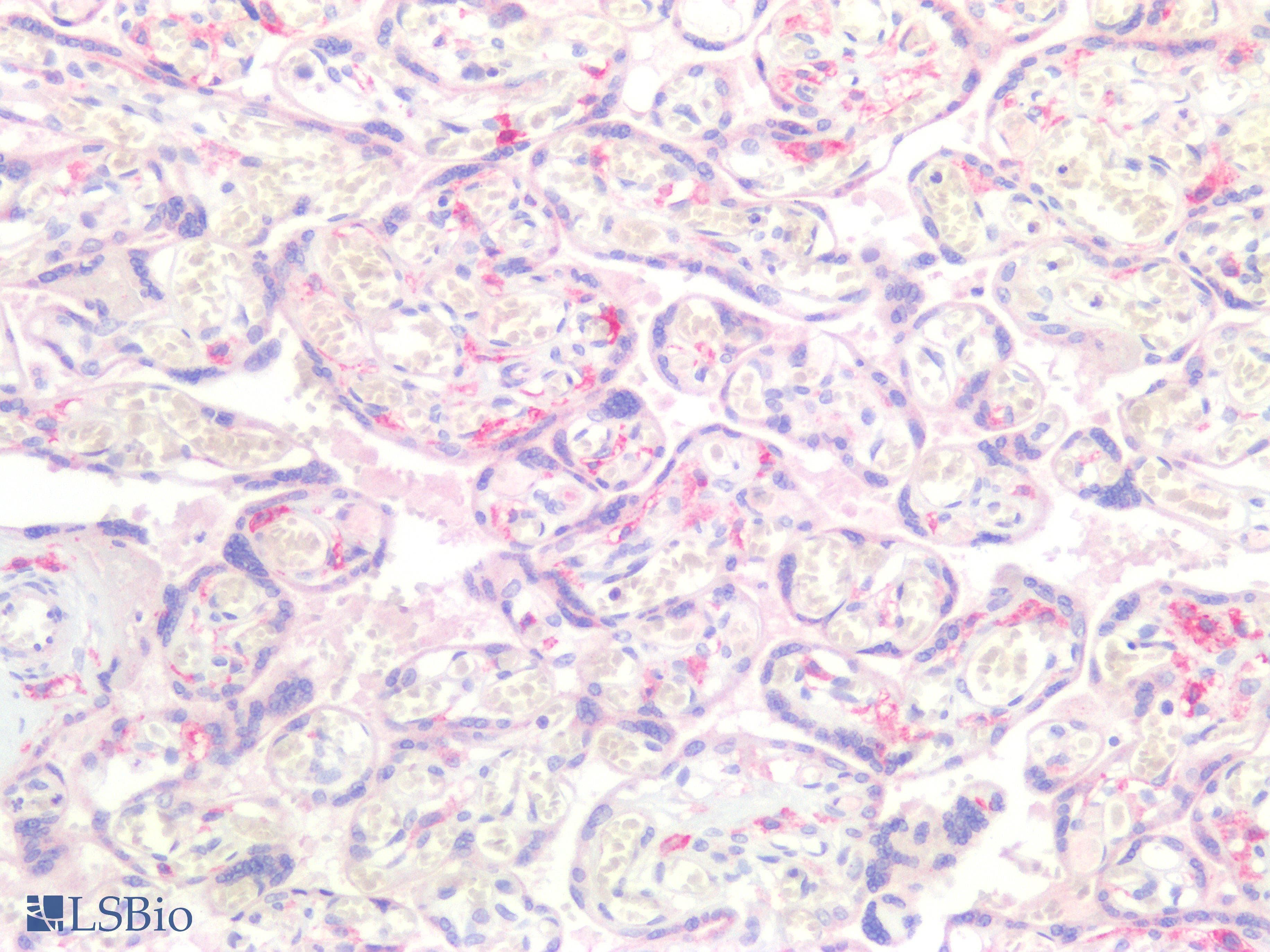 IHC-plus™ Polyclonal Rabbit anti-Human FBP / FOLR2 Antibody (aa25-55, IHC, WB)
