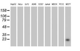 PYCARD / ASC / TMS1 Antibody (clone OTI1A2)