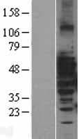 Human MAP3K8 / TPL2 Protein (Over-Expression Lysate Myc-DDK (Flag))