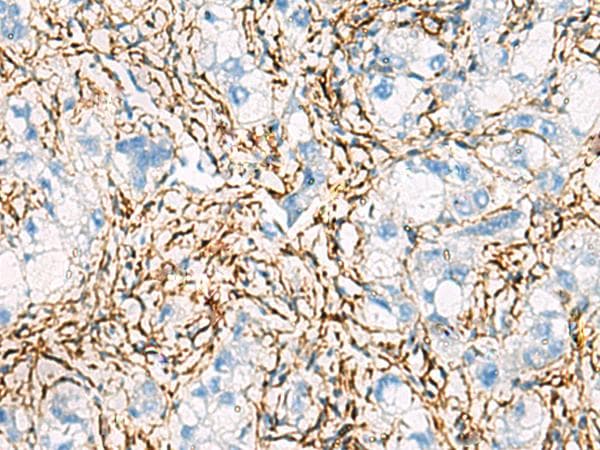 ACTC1 / Alpha Cardiac Actin Antibody