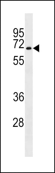 Polyclonal Rabbit anti-Human STKLD1 / SgK071 Antibody (aa583-609, WB)