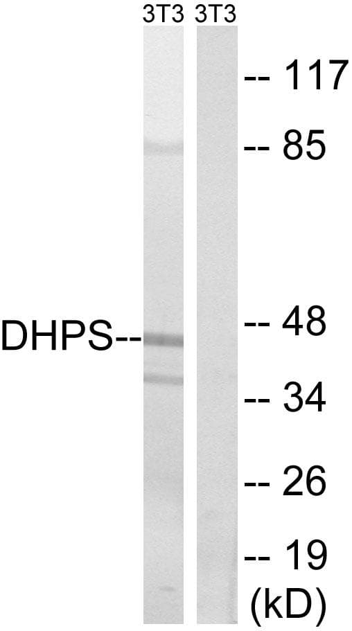 DHPS Antibody