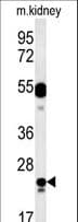 Polyclonal Rabbit anti-Human LYSMD1 Antibody (aa198-227, IHC, WB)