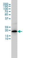Monoclonal Mouse anti-Human MRPL12 Antibody (clone 3B12-1A3, IHC, IF, WB)