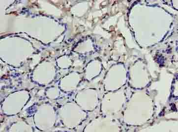 Polyclonal Rabbit anti-Human SDSL / Serine Dehydratase-Like Antibody (IHC, WB)