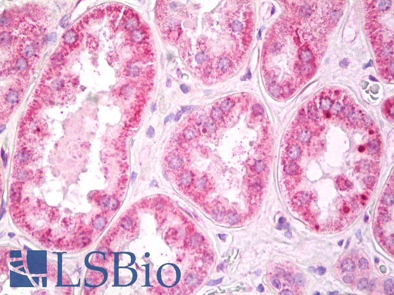 IHC-plus™ Polyclonal Rabbit anti-Human PRKAB1 / AMPK Beta 1 Antibody (aa4-34, IHC, WB)