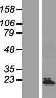 KHDC1 / C6orf148 Protein (Over-Expression Lysate Myc-DDK (Flag))