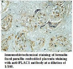 PLAC1 Antibody (aa26-192)