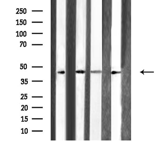 ARFIP1 Antibody