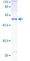 Human PSMD9 / 26S Proteasome Protein (Recombinant GST)