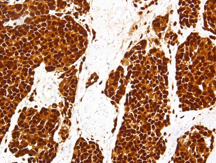 SOX10 Antibody (clone AHC0235, Ready-to-Use)