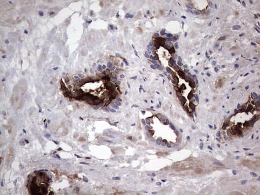 MMP7 / Matrilysin Antibody (aa95-267, clone OTI3G7)
