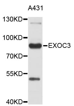 Polyclonal Rabbit anti-Human EXOC3 / SEC6 Antibody (IHC, WB)