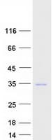 Human RAB23 Protein (Recombinant Myc-DDK (Flag))