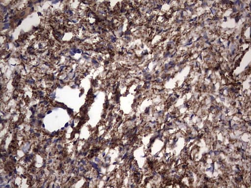 IL1RN Antibody (clone OTI2B1)