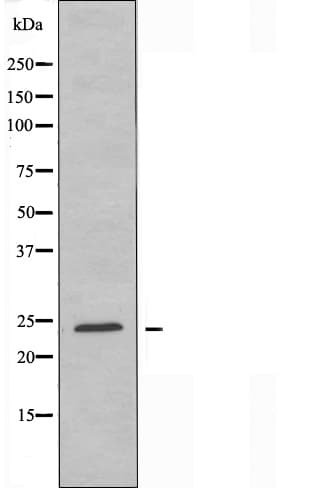 Polyclonal Rabbit anti-Human PGRMC2 Antibody (IF, WB)