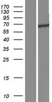 FBXW11 Protein (Over-Expression Lysate Myc-DDK (Flag))