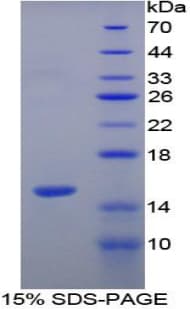 Human VCL / Vinculin Protein (Recombinant His)