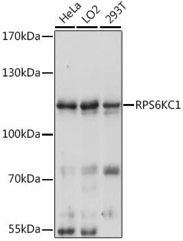 Polyclonal Rabbit anti-Human RPS6KC1 Antibody (WB)