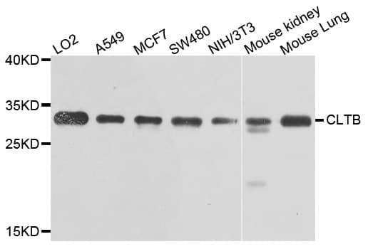 Polyclonal Rabbit anti-Human CLTB Antibody (WB)