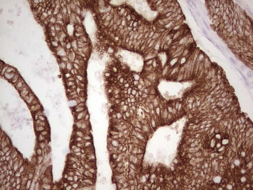 ABCB1 / MDR1 / P Glycoprotein Antibody (aa995-1280, clone OTI1A7)