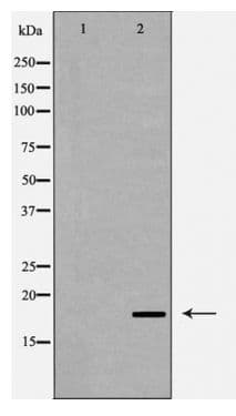 CASP6 / Caspase 6 Antibody