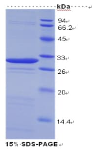 Human LGALS3 / Galectin 3 Protein (Recombinant His)