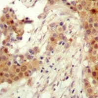 Polyclonal Rabbit anti-Human AKT2 Antibody (C-Terminus, IHC, WB)