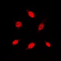 RB1 / Retinoblastoma / RB Antibody (C-Terminus)