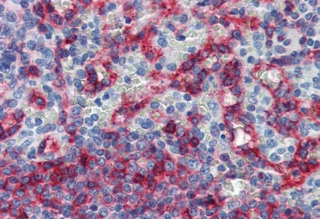 HLA-E Antibody (clone MEM-E/07)
