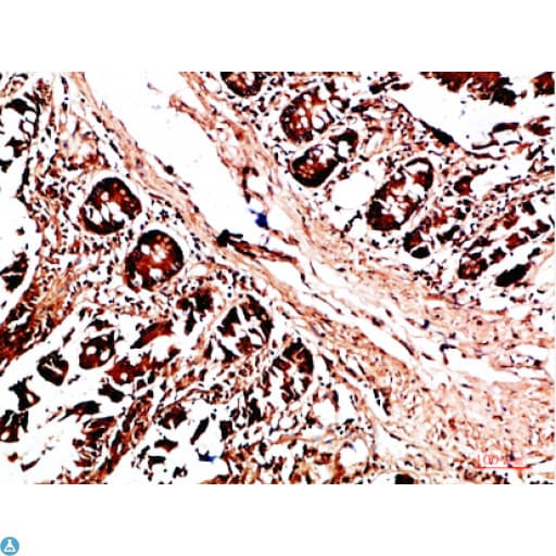 Polyclonal Rabbit anti-Human HLA-DQA1 Antibody (IHC)