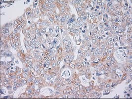 KRT19 / CK19 / Cytokeratin 19 Antibody (clone OTI4E12)