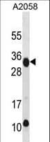 NKG2DL4 / ULBP4 Antibody (aa150-179)