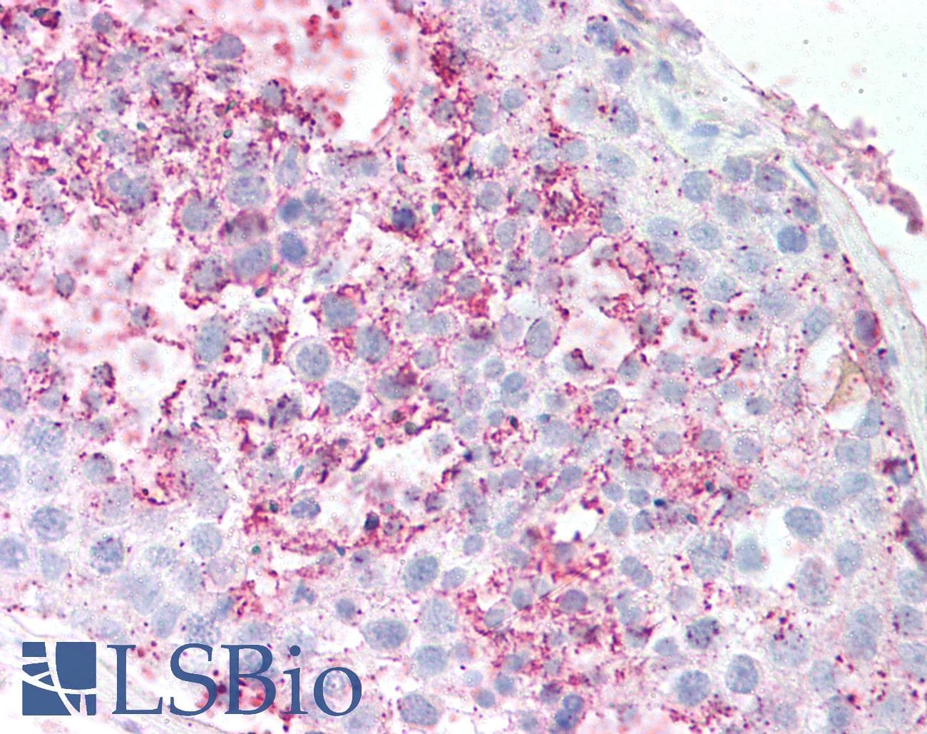 PathPlus™ GPCRW / GPR18 Antibody (Extracellular Domain)