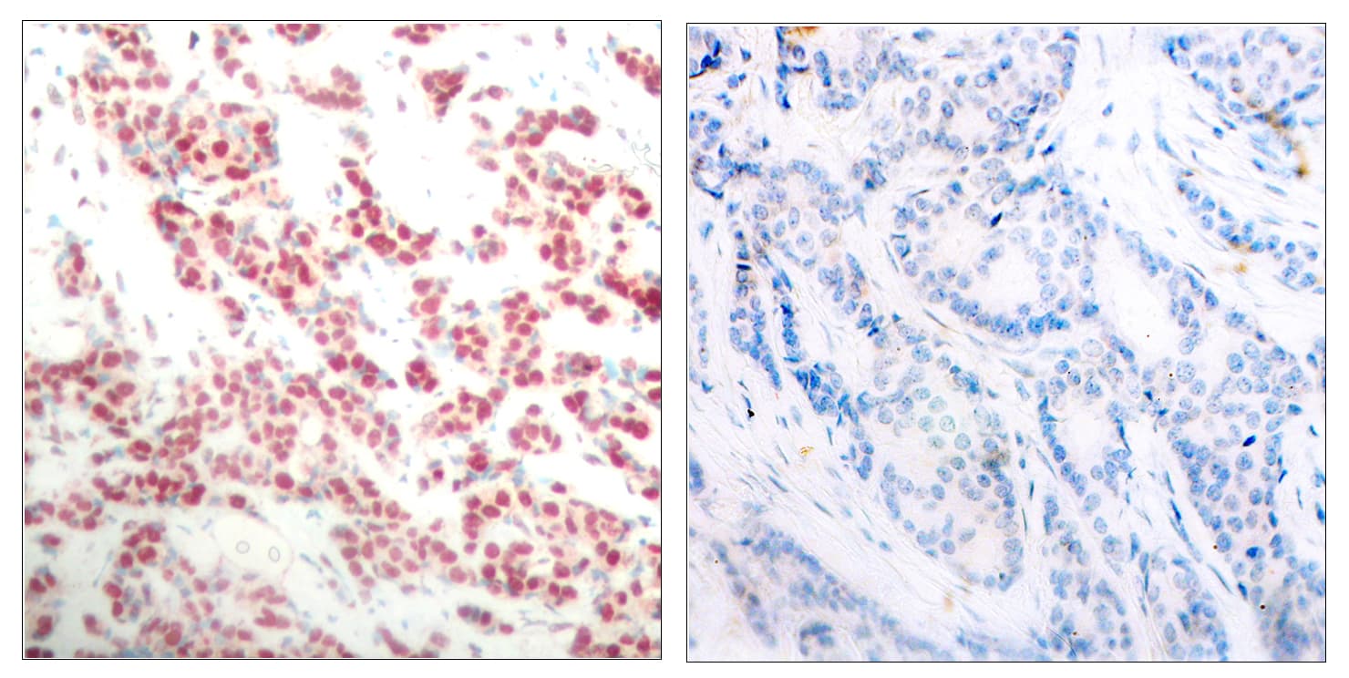NFKB2 Antibody (phospho-Ser865)