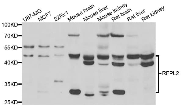 RFPL2 Antibody
