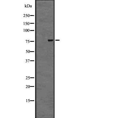 ADGRG1 / GPR56 Antibody
