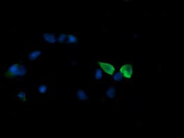 MAP2K3 / MEK3 / MKK3 Antibody (clone OTI6B12)