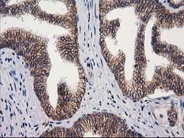 PON1 / ESA Antibody (clone OTI1F7)