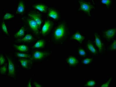 Polyclonal Rabbit anti-Human AMIGO2 Antibody (IHC, IF, WB)