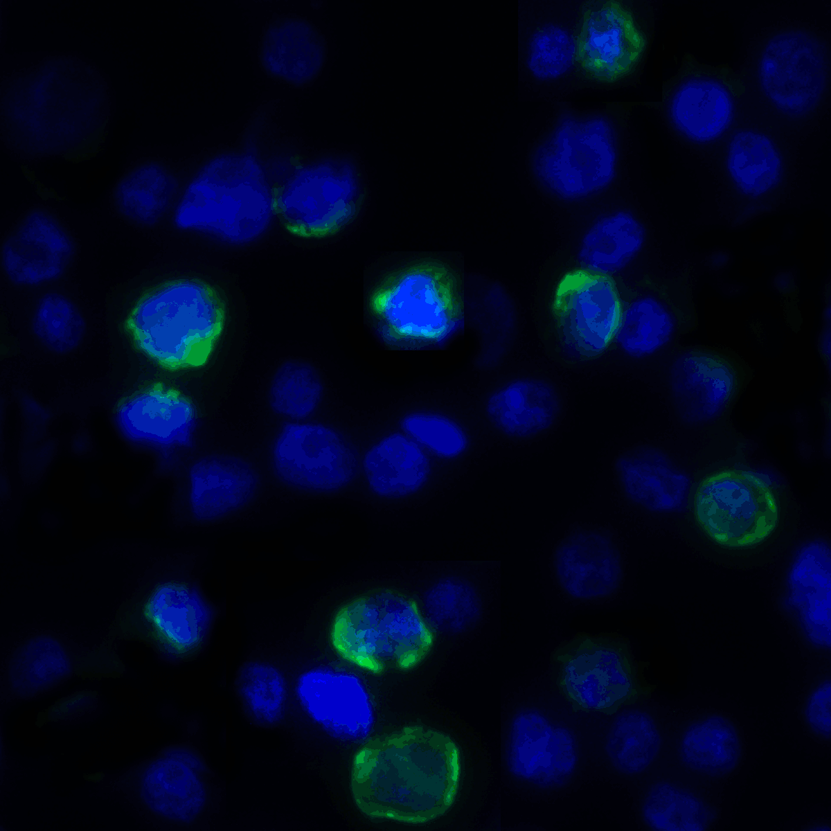 IHC-plus™ VSIR / GI24 / VISTA Antibody (clone 8E11)