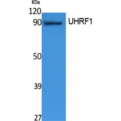 Polyclonal Rabbit anti-Human UHRF1 Antibody (Internal, WB)