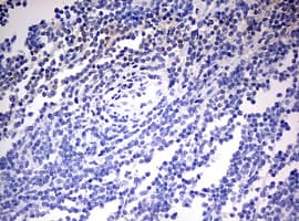 OAS2 Antibody (aa60-335, clone OTI5E1)