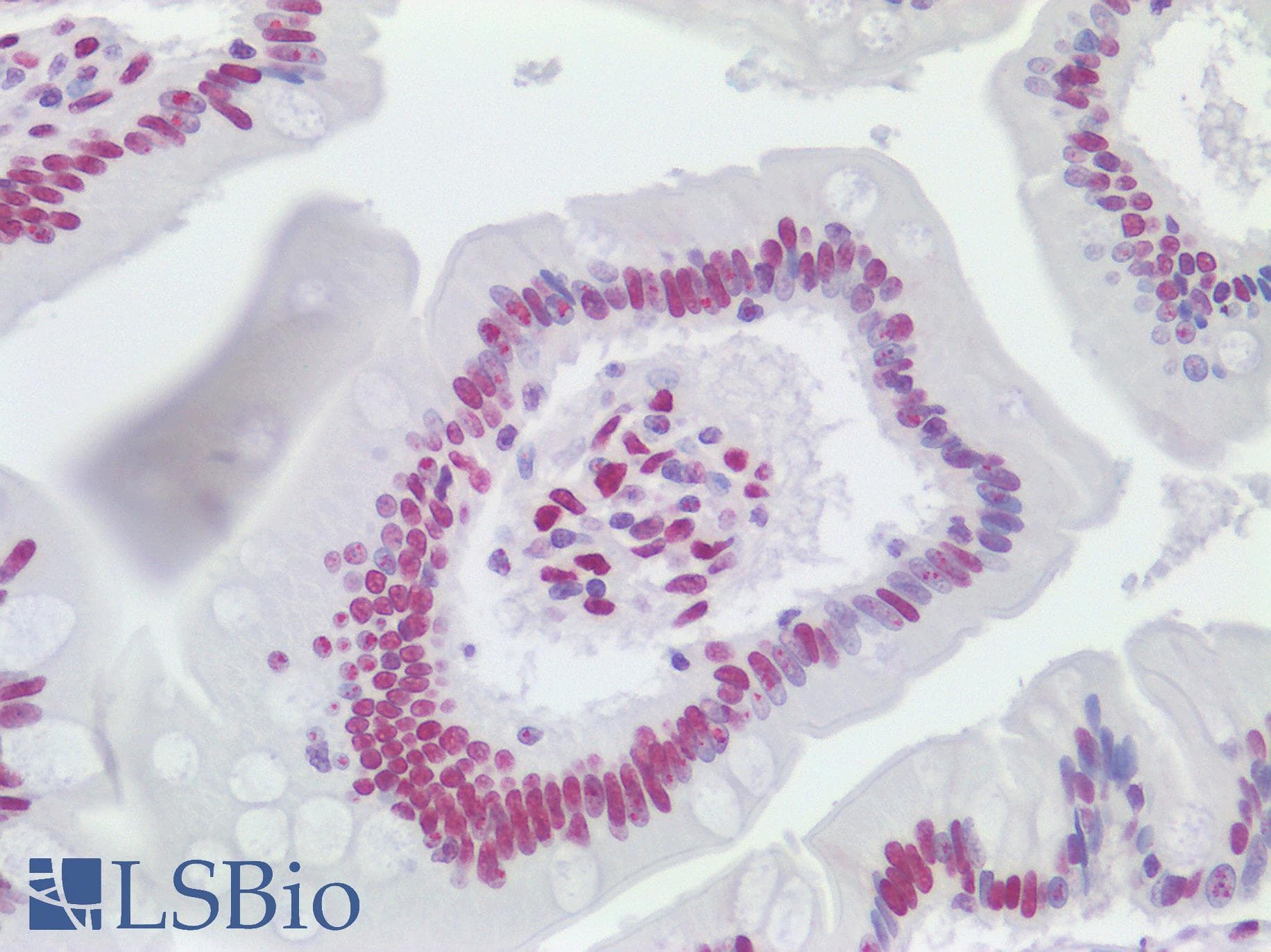 IHC-plus™ Polyclonal Rabbit anti-Human KHSRP / FBP2 Antibody (aa100-150, IHC)